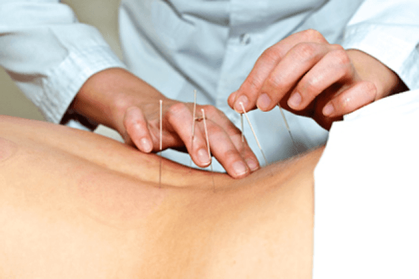 Acupunctura pentru alcoolism